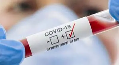 করোনা: চট্টগ্রামে ২৪ ঘণ্টায় শনাক্ত ৩ জন